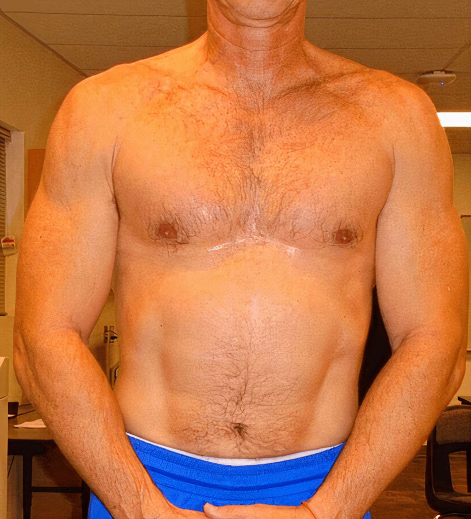 man after testosterone steroid for weight loss